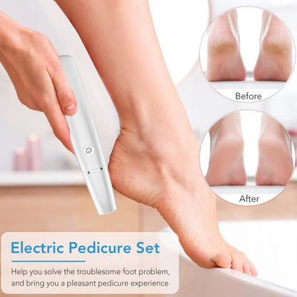 🌸Mother's Day Hot Sale 49%🌸Electric Feet Callus Remover