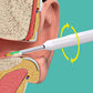 🔥🖤Black Friday Sale:50% OFF🔥Endoscopic Visual Ear Picker
