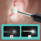 🔥🖤Black Friday Sale:50% OFF🔥Endoscopic Visual Ear Picker