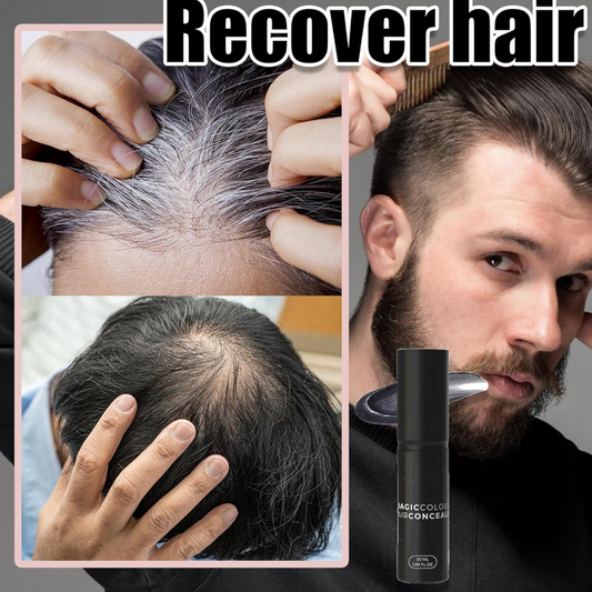 💁‍♂️Last Day-Buy 1 Get 1 Free!🎁💧Scalp Concealer for Fuller, Natural-Looking Hair