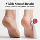 🔥LAST DAY B1G1 FREE 🦶 £7.99｜Double‑Sided Foot Scraper for Callus & Dead Skin